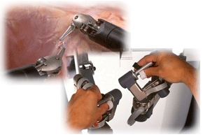 手術支援ロボット「ダヴィンチ」イメージ