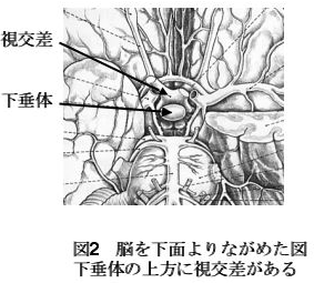 非機能性腺腫イメージ1